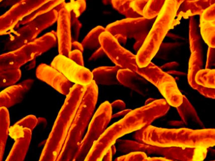 Processed Foods Leading To Reduced Gut Microbiome Diversity